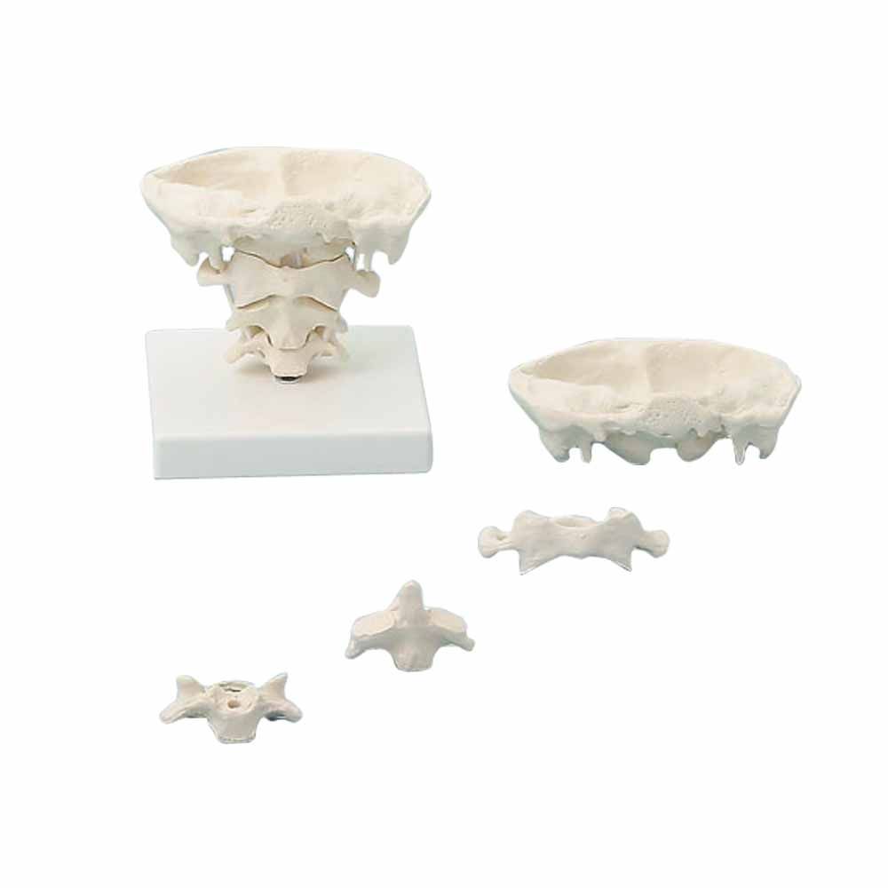 Erler Zimmer Modell der Kopfgelenke: Wirbelsäulenmodell mit Gelenkstücken und kleinen Teilen, beige