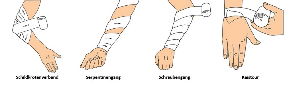 Fixierverband techniken